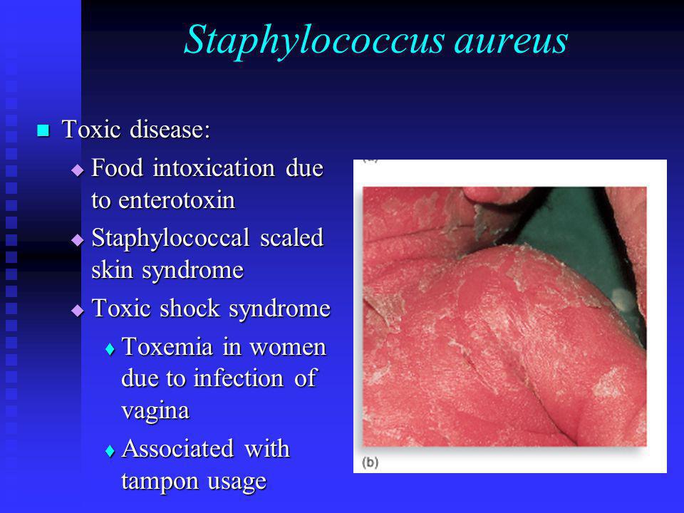 aureus vagina staphylococcus and